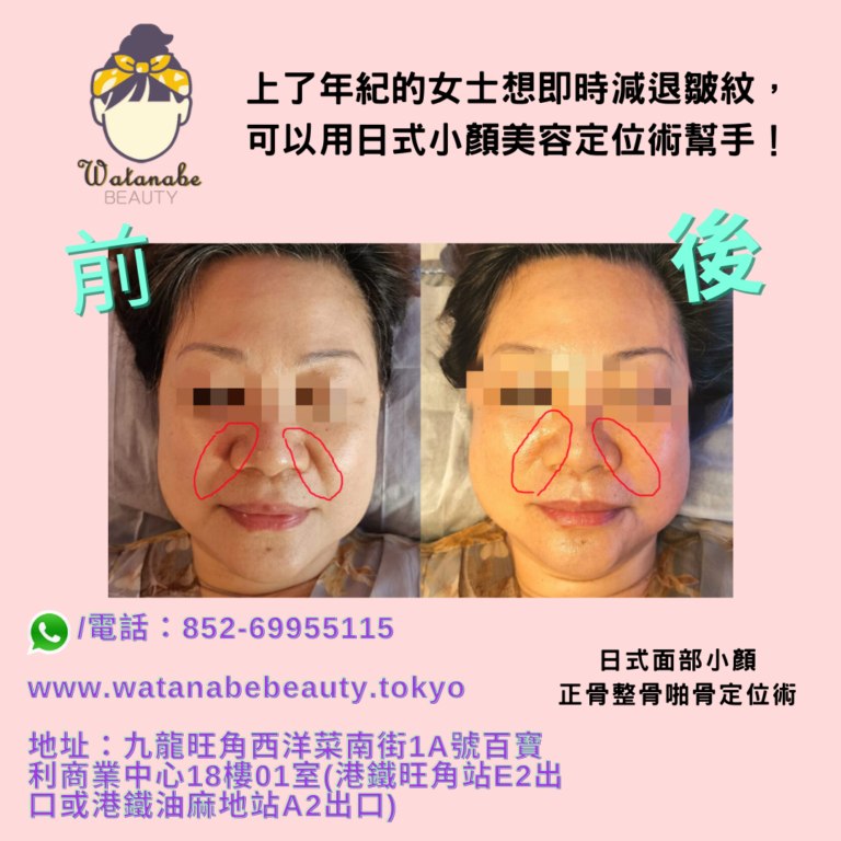 上了年紀的女士想即時減退皺紋，可以用日式小顏美容定位術幫手！